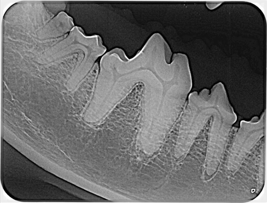 Dental radiograph showing detailed tooth structure