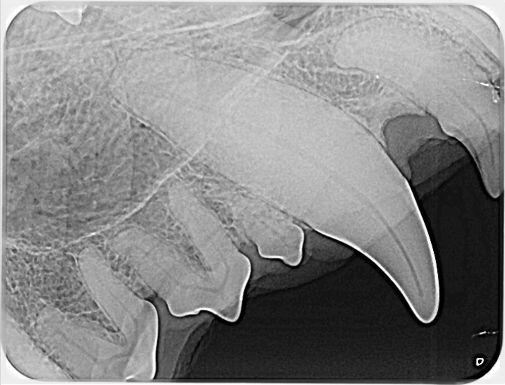 Dental radiograph showing tooth alignment