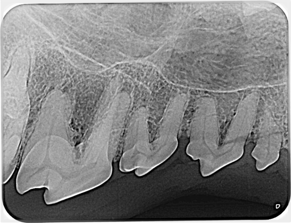 Dental radiograph showing comprehensive view