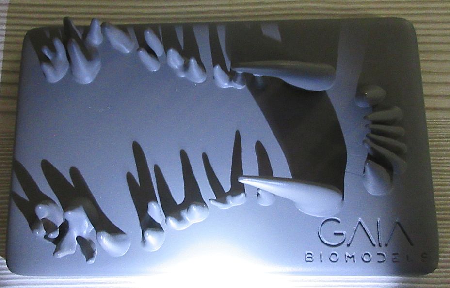 Second view of the shadow demonstration model showing how X-ray beam angulation changes the projected tooth shadows